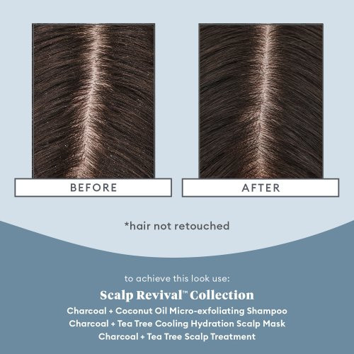 Briogeo Scalp Revival Scalp Soothing Solutions Set Komplekt