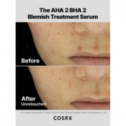 COSRX The AHA 2 BHA 2 Blemish Treatment Serum Seerum probleemsele nahale 50g