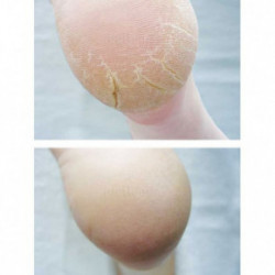 Footlogix Cracked Heel Formula Vaht lõhenenud jalgadele 125ml