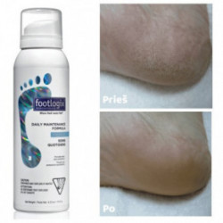 Footlogix Daily Maintenance Formula Vaht igapäevaseks jalahoolduseks 125ml