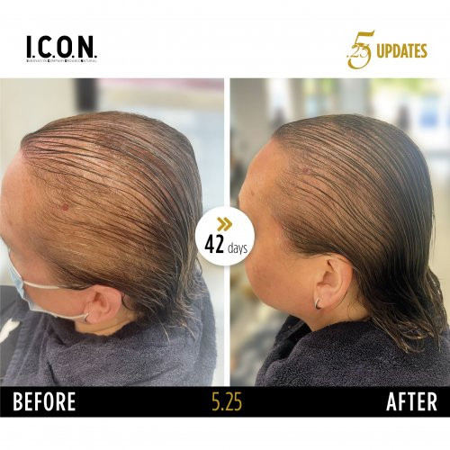 I.C.O.N. 5.25 Hair Growth Replenisher Juuste väljalangemise vastane seerum 100ml