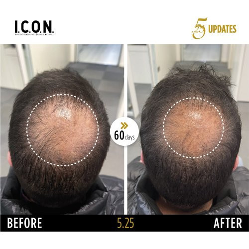 I.C.O.N. 5.25 Hair Growth Replenisher Juuste väljalangemise vastane seerum 100ml