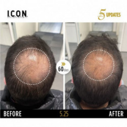 I.C.O.N. 5.25 Hair Growth Replenisher Juuste väljalangemise vastane seerum 100ml