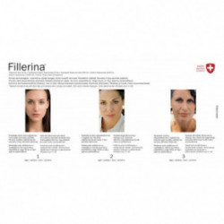 Fillerina Dermo-Cosmetic Filler Treatment Dermakosmeetiline täiteaine komplekt Grade 2
