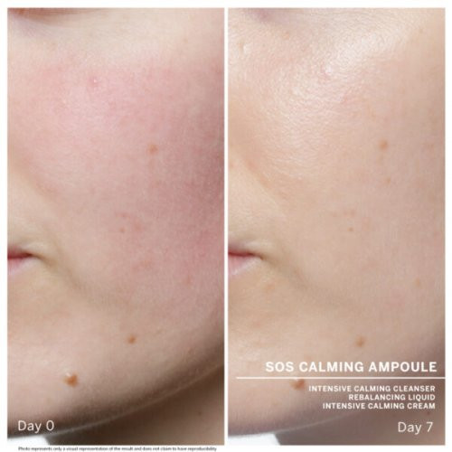 Babor SOS Calming Ampoule Concentrate Rahustavad ampullid näole 7x2ml