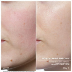 Babor SOS Calming Ampoule Concentrate Rahustavad ampullid näole 7x2ml